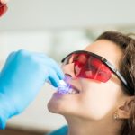 Professional vs At-Home Teeth Whitening: Key Differences Explained